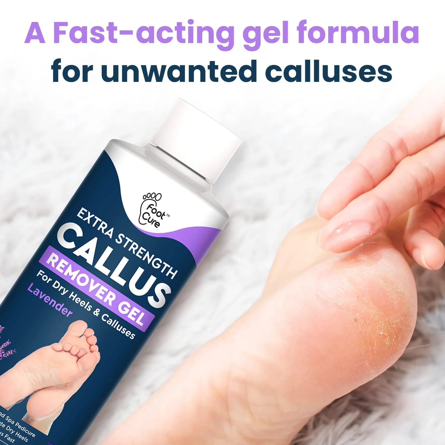 Lavender Foot Soak & Callus Remover Gel Kit - Remove Calluses with Epsom Salts, Callus Remover Gel for Dry Cracked Heels & Foot Odor